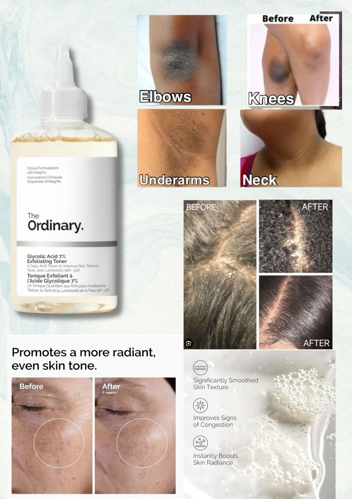 The Ordinary Glycolic Acid
