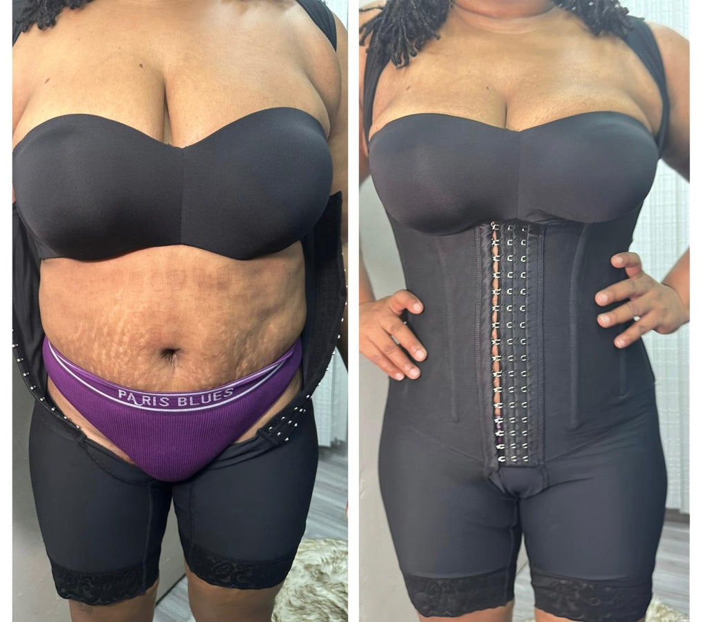 Stage 3 Colombian Faja with Bones